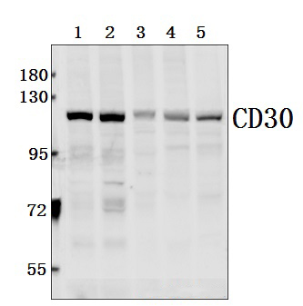 CD30 (Q21)