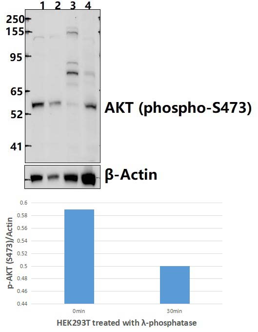 AKT (phospho~S473)