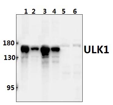 ULK1 (S317)