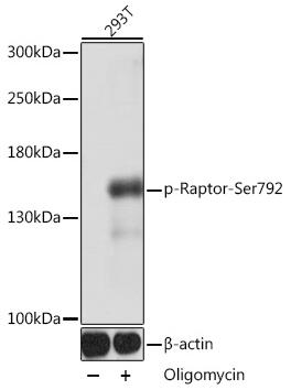Raptor (phospho~Ser792)