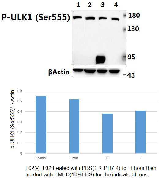 ULK1 (phospho~Ser555)