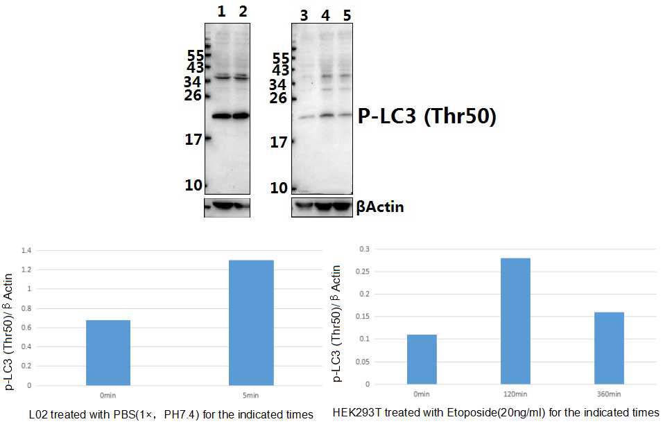 LC3 (phospho~Thr50)