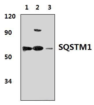 SQSTM1