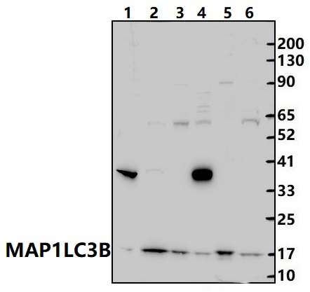 MAP1LC3B