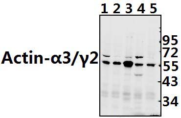 Actin~α3/γ2 (E2)