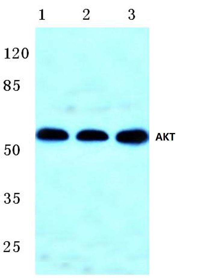 AKT (F469)