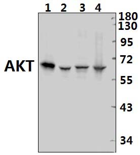 AKT (P467)