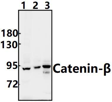 Catenin~β (I35)