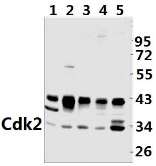 Cdk2 (V154)