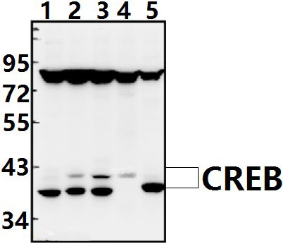 CREB (I127)