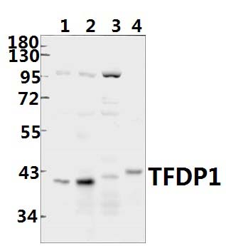 TFDP1 (V393)