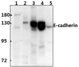 E~Cadherin (R868)