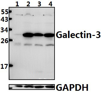 Galectin~3 (N174)