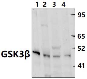 GSK3β (S13)