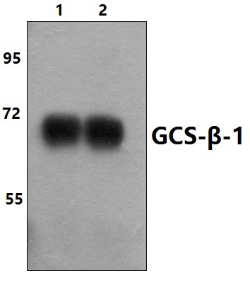 GCS~β~1 (V21)