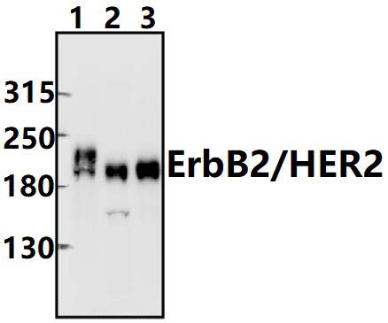 ErbB2/HER2 (T1242)