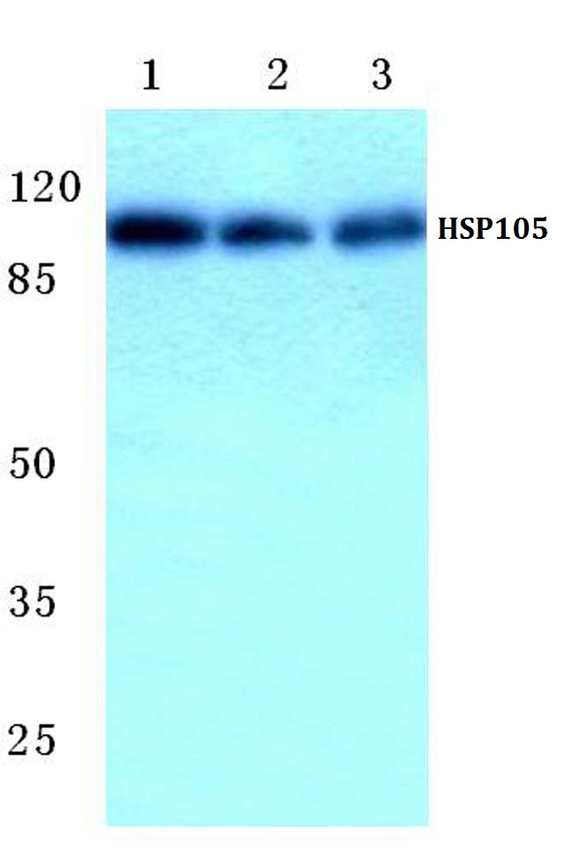 HSP105 (P819)