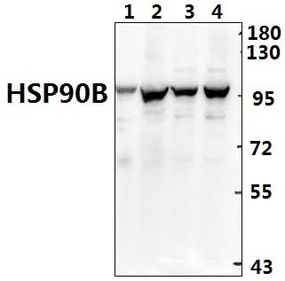 HSP90B (K248)
