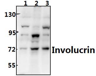 Involucrin (P568)