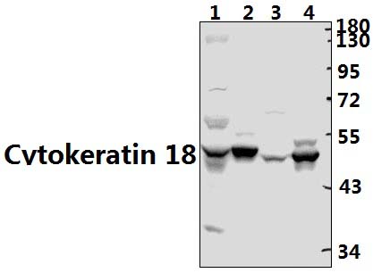 Cytokeratin 18 (T410)