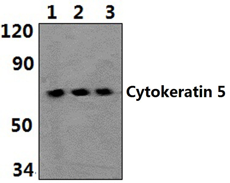 Cytokeratin 5 (S573)