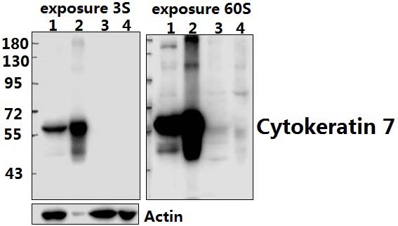 Cytokeratin 7 (L451)