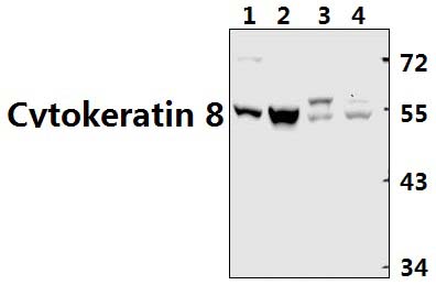 Cytokeratin 8 (V67)