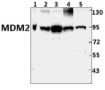 MDM2 (F414)
