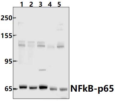 NFkB~p65 (G530)