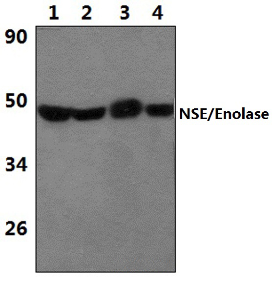 NSE/Enolase (R400)