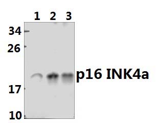 p16 INK4a (A20)