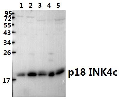 p18 INK4c (D142)