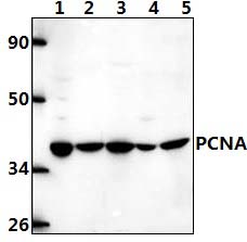 PCNA (I88)