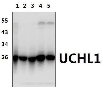 UCHL1 (R202)