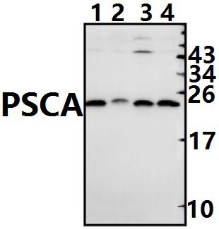 PSCA (V71)