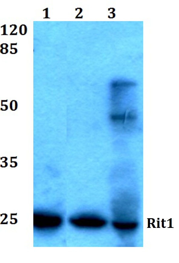 Rit1 (W204)