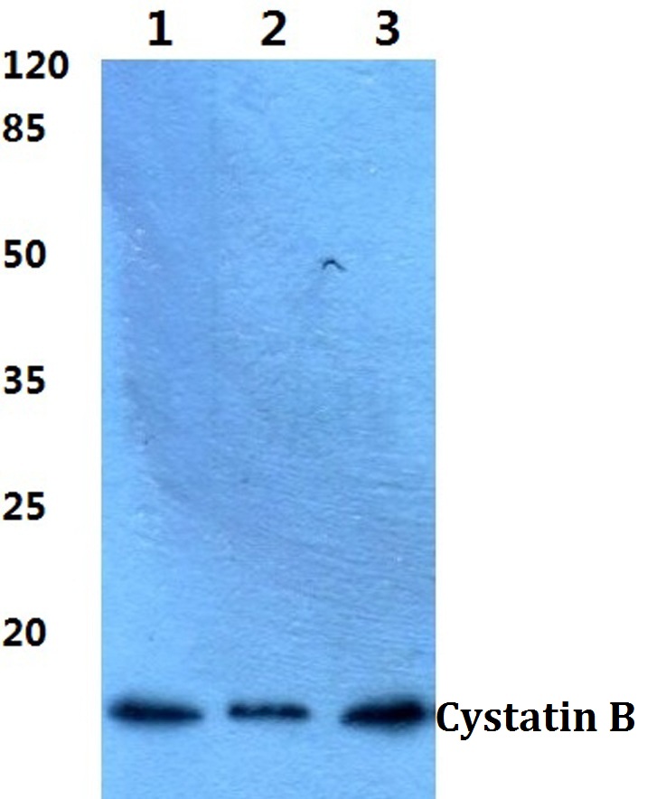 Cystatin B (N84)