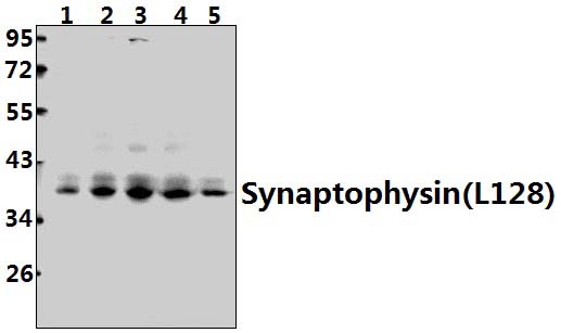 Synaptophysin (L128)