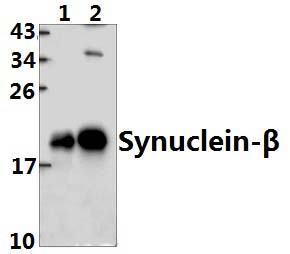 Synuclein~β (S118)