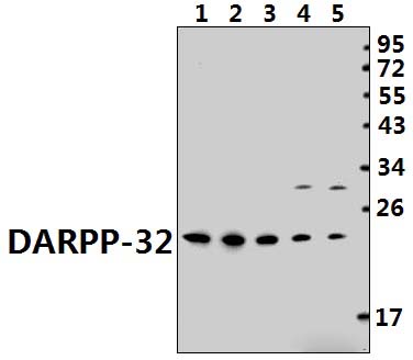 DARPP~32 (P69)