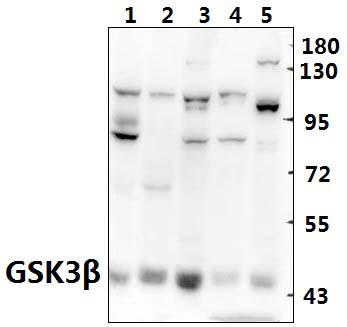 GSK3β (S2)