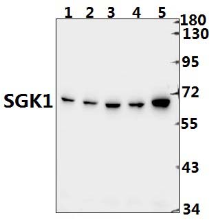 SGK1 (E416)