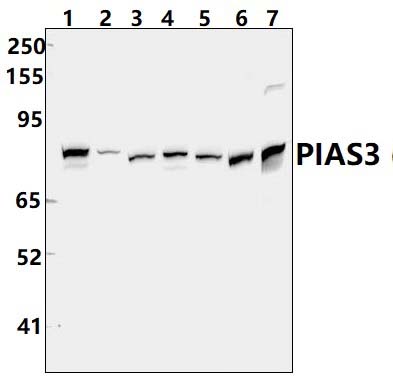 PIAS3 (F25)