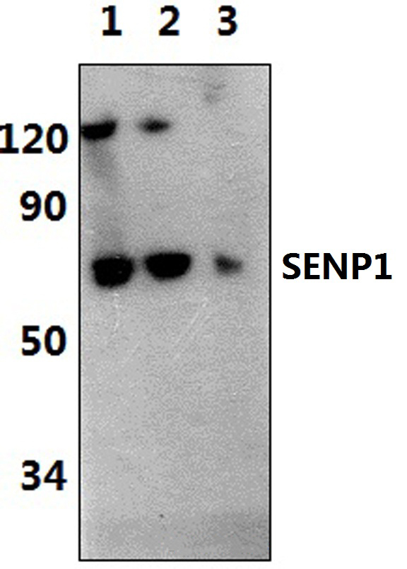 SENP1 (D2)