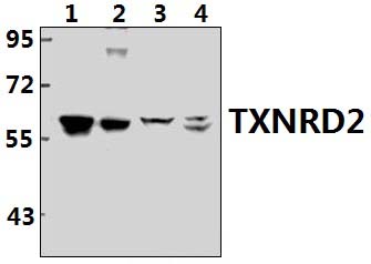 TXNRD2 (S501)