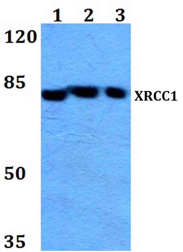 XRCC1 (G552)