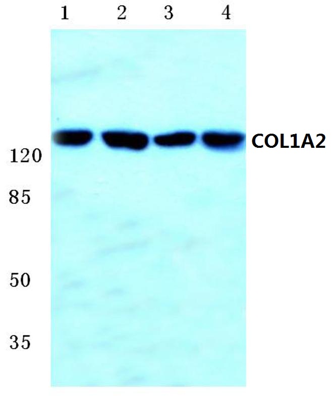 COL1A2 (S3)