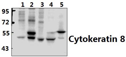 Cytokeratin 8 (G427)