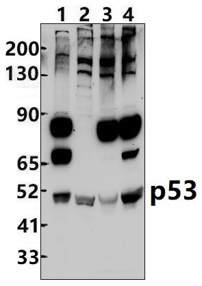 p53 (Ab~20)