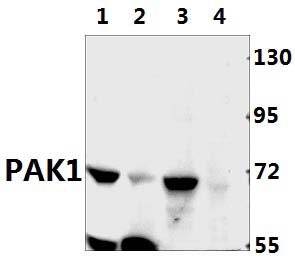 PAK1 (I206)